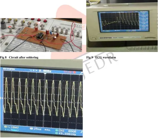Fig 6 Circuit in breadboard                                                                   Fig 7  ECG waveform 