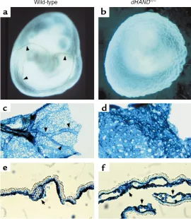 Figure 4Yolk sac vascular defects in