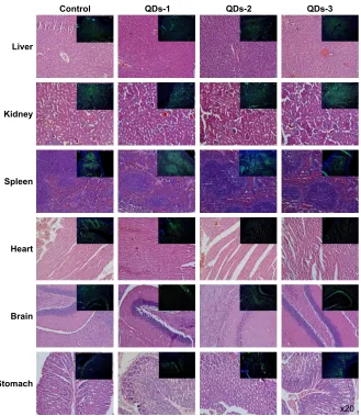 Figure S4 representative images of organ histology and lysosomes distribution analysis (green color) of main organs in QDs-injected and control mice groups