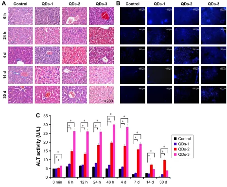 Figure 6 representative images of organ histological and lysosomes distribution analysis (green color) of liver and spleen in QDs-injected and control groups.Note: assessment was carried out by pathologists after 40 days postinjection of QDs.Abbreviation: QDs, quantum dots.