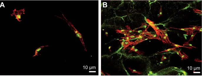 Figure 5 Confocal microscopic images of actin-stained hMSCs on (A) control Ti and (B) modified Ti after 6 h of incubation