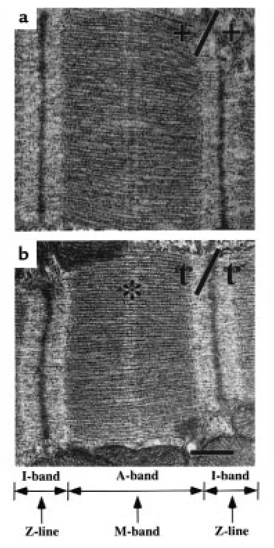 Figure 5Transmission electron micrographs of sarcomeres from 12-week-old