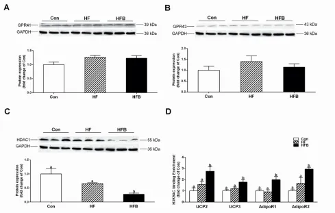 Figure 4: Sodium butyrate suppresses HDAC1 expression and modifies histone acetylation