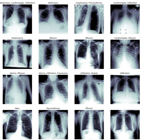 Fig 1. Convolution Architecture Proposed and Used for  Image Classification by Alex Krizhevsky et al