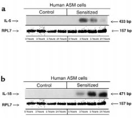 Figure 3Comparison of expression of IL-5 (