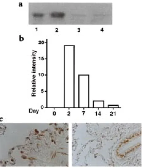 Figure 1a