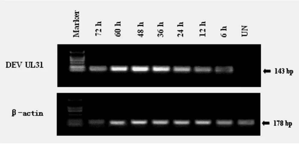 Figure 5Character of the UL31 RNA expression in infected DEF(UN) and infected DEF at different times p.i