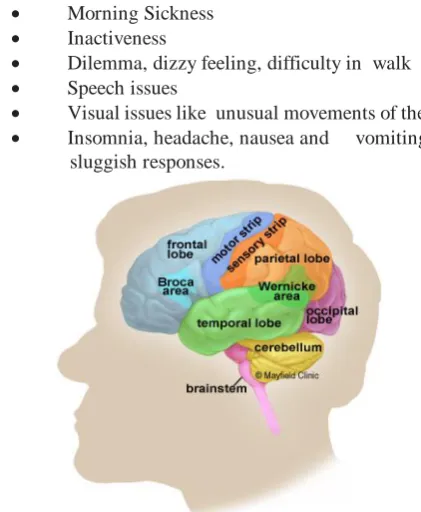 Fig 1. The brain tumours from various brain regions 