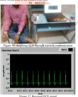 Figure 16: Acquiring ECG through wireless communication 