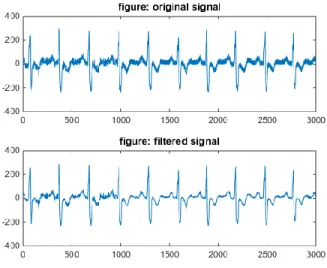Table 3 Coefficients and corresponding frequency  DWT coefficient   Range of frequency 