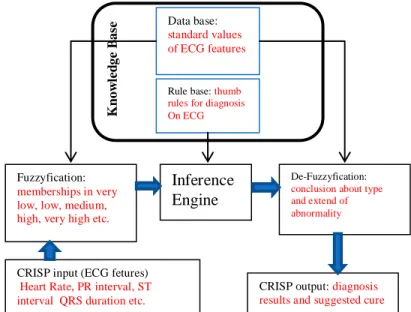 Figure 4 QRS detection results 