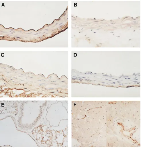 Figure 3. Immunohistochemical staining for eNOS in the aorta (A–D), lung (E), and heart (F)