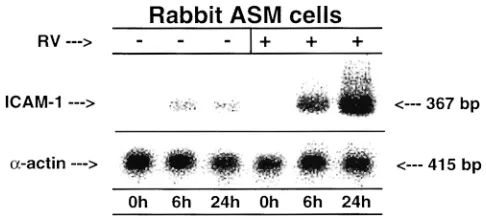 Figure 7. Southern blots of ICAM-1 and �-actin mRNA expression in rabbit ASM cells after 0, 6, and 24 h of inoculation in serum-free media in the absence (�) and presence (�) of RV