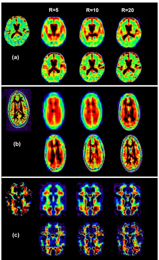Figure 3.3: Simulation 1 for Bayesian tensor decomposition results: panel (a): DTI image;
