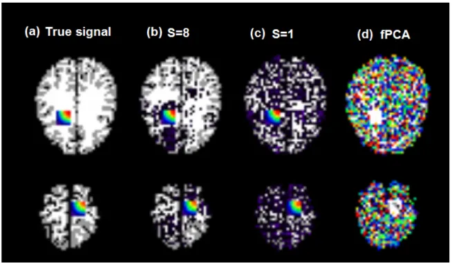 Figure 3.5: Results of the 3-D image example. In each panel, we show axial views of the 2 true signal regions and a 3D render of the results overlaid on the template G 0 from left to right
