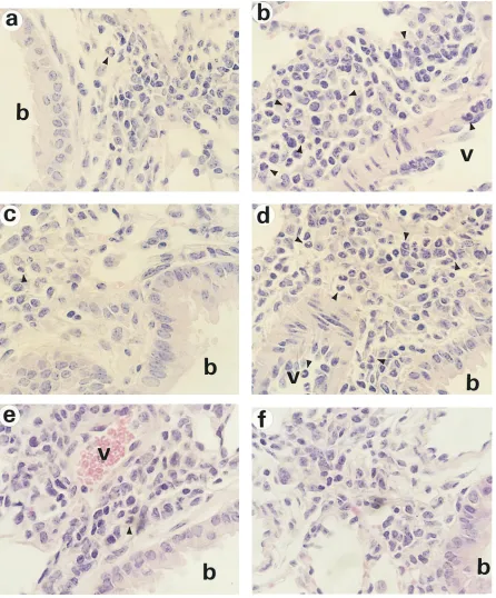 Figure 8. Histopathologic changes in the lung. Lung tissues were obtained at day 3 after OVA challenge from IL-5IL-5ery (��� mice (a), IL-5+/+ mice (b), ��� mice with i.m