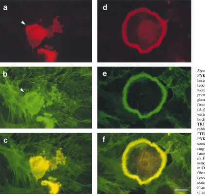 Figure 9. Localization of 