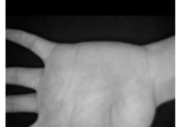 Fig 1: surface of palmar region 