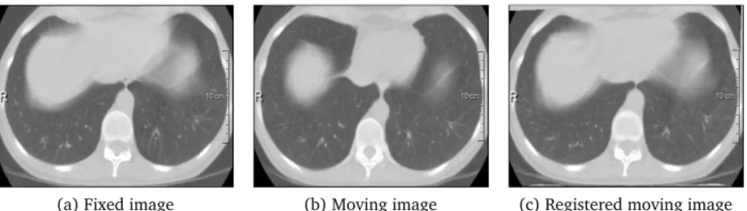 Figure 1.1: Example of deformable image registration on lung CT images.