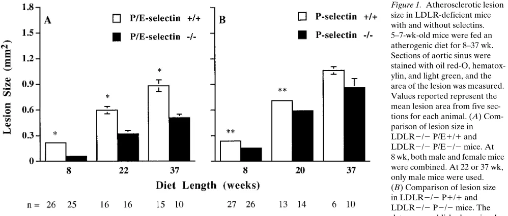 Figure 1. Atherosclerotic lesion 