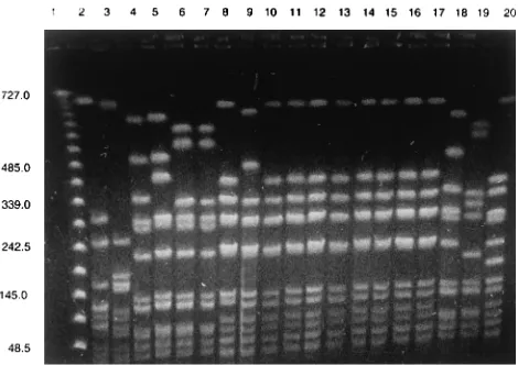 FIG. 2. Photograph showing a representative selection of isolates on PFGE.Lane numbers: 1, lambda ladder marker (48.5-kb bacteriophage lambda DNA