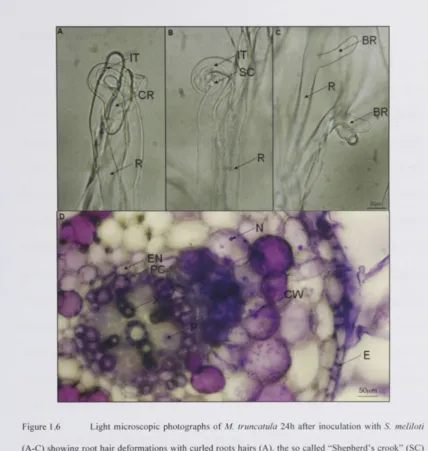Figure 1.6 Light microscopic photographs of M. truncatula 24h after inoculation with S