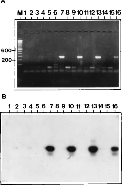 FIG. 3. (A) Agarose gel showing representative PCR results with parafﬁn-embedded tissue specimens from experimentally infected animals