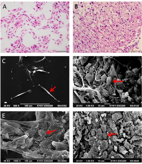 Figure 1: Comparison of glioma cell morphology by H&E staining and SEM. Primary glioma cells in 2D and 3D culture with H&E staining A and B