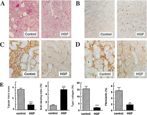 Figure 2. Beneficial effects of HGF injections on tubular injury and tubulointerstitial fibrosis
