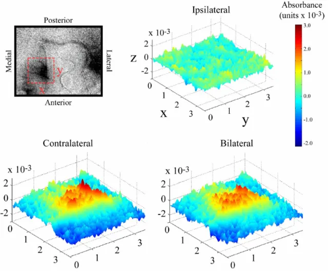Figure 4.3.  Surface plots of absorbance evoked in SI by contralateral, ipsilateral, and bilateral 