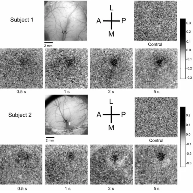Figure 5.1.  Difference images evoked by stimulation of the contralateral thenar pad in two exemplary 