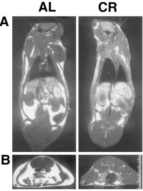 Figure 2. Body composition by MRI. The bright white color depicts fat tissue. (A) Coronal cut in the dorsal plane which demonstrates the kidneys and the surrounding perinephric fat, in AL and CR 18-mo-old rats
