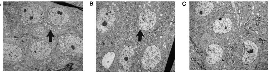 Figure 6. Improvements in auditory function are observed in MPS VII mice after enzyme replacement therapy initiated at birth