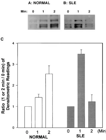 Figure 2. Time curve of the anti-CD3 mAb-mediated lupus T cell protein tyrosine phosphorylation