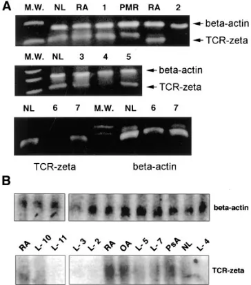 Figure 5. Detection of TCR� chain mRNA. RT-PCR (A). Two prim-ers were constructed for the � chain and the products were analyzed electrophoretically in 1% agarose gels prepared with Tris-borate EDTA buffer, stained with 20 �g ethidium bromide, and photo-gr