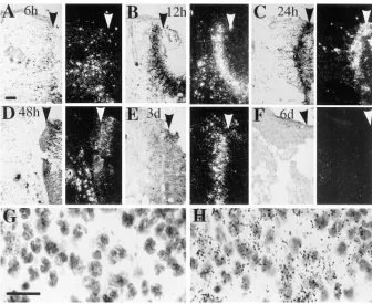 Figure 3. Expression of cisional injury. Full-thickness skin inci-sions were collected at various times after injury, and in situ hybridization was carried out using an antisense [spp1 after skin in-35S]UTP-labeled spp1 riboprobe