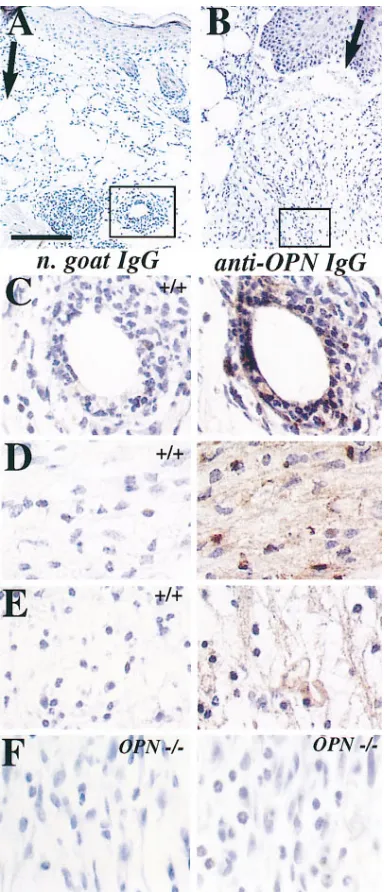 Figure 4. Localization of OPN in skin wounds. (nification views of skin incisions 4 d after injury in wild-type animals, showing position of A and B) Low mag-C and D (boxed regions) relative to the incision plane (black arrows)