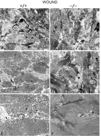 Figure 5. Differences in the reestablish-ment of matrix architecture after a full-thickness dermal wound in OPN mutant versus wild-type mice
