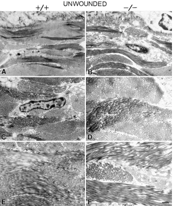 Figure 7. Comparison of dermal architec-ture from unwounded regions in OPN mu-tant and wild-type mice