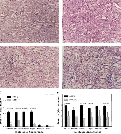 Figure 2. Histologic evaluation of kidney after cisplatin injection. Representative sections from either 1 d (A and B) or 3 d (D and E) after injec-tion of wild-type (A and D) or p21(�/�) mice (B and E)