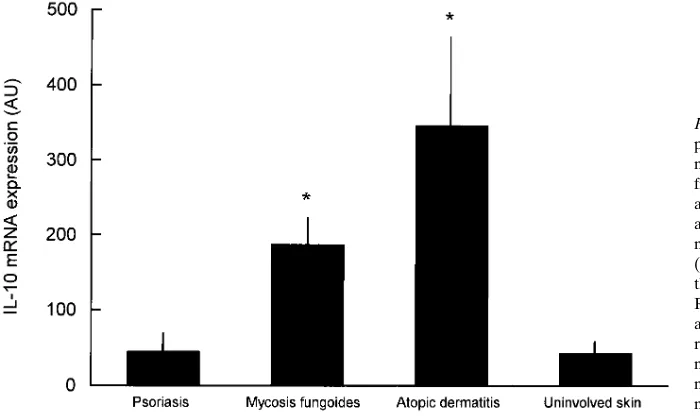 Figure 2. Decreasing TNF-� but increasing IL-10 mRNA expression in response to ini-tial conventional psoriasis therapy