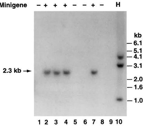 Figure 1. Schematic representation of the hTF minigene. Filled boxes indicate hTF cDNA sequences (the taller region repre-sents the coding region and the shorter re-gion represents the 5� and 3� noncoding re-gions)