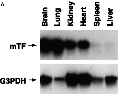 Figure 3. Tissue-specific expression of the hTF mRNA. (petitor plasmid (330 bp) (lanes weight markers (A) Total RNA was extracted from brain, lung, kidney, heart, spleen, and liver of a nontransgenic mouse