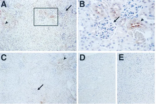 Figure 9. Expression of hTF protein in the kidney of a rescued mouse. Photomicrographs of renal cortical tissue demonstrating the distribution of hTF and mTF antigen by immunoperoxidase staining using a polyclonal goat anti–human TF antibody (American Diag