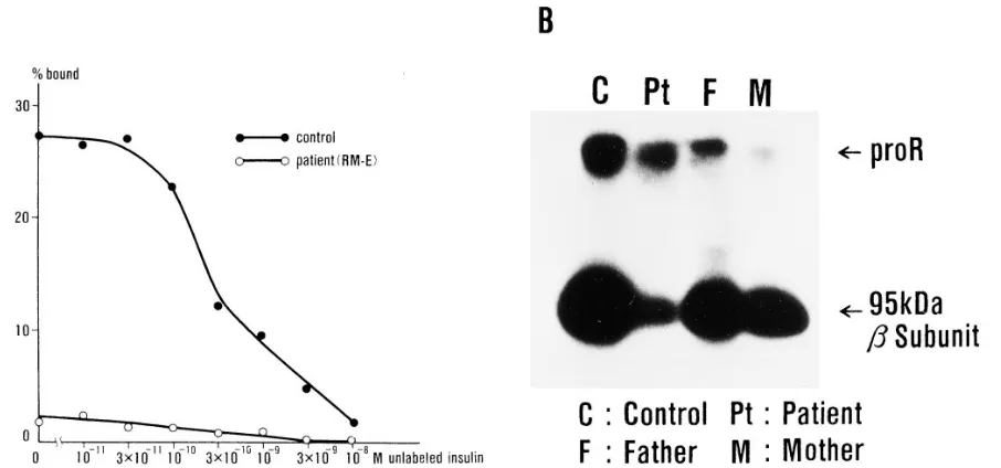Figure 2. Immune complex kinase assays in transformed lymphocytes. (insulin in the patient reached about one-half of the maximal response in the control