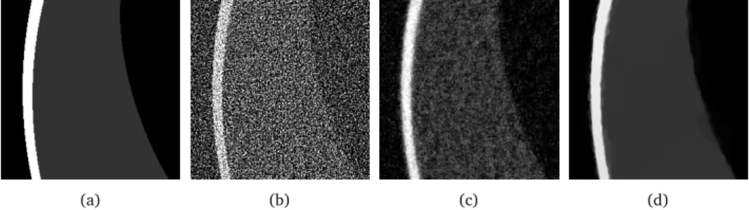 Figure 1.5: Zoomed-in reconstructions of the Shepp-Logan head phantom (a), showing the resulting images of three different reconstruction methods: (b) FBP, (c) SIRT, and (d) total variation minimization