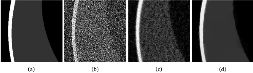 Figure 4.2: Zoomed-in reconstructions of the Shepp-Logan head phantom (a), showing the resulting images of three different reconstruction methods: (b) FBP, (c) SIRT, and (d) total variation minimization