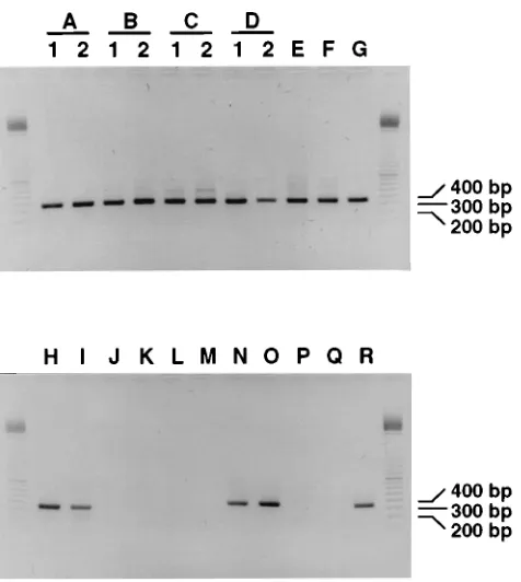 FIG. 4. Compilation of different experiments showing nested PCR signals offeces from HIV-1-infected individuals A to R