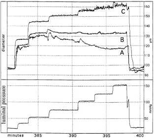 Figure 2. Typical recordings showing the internal containing EGTA (2 mM) and sodium nitroprus-side (10 with a flow rate of either 0 obtained in a Cadiameter and the luminal pressure measured inresistance mesenteric artery segments isolated from a Vim��� mo