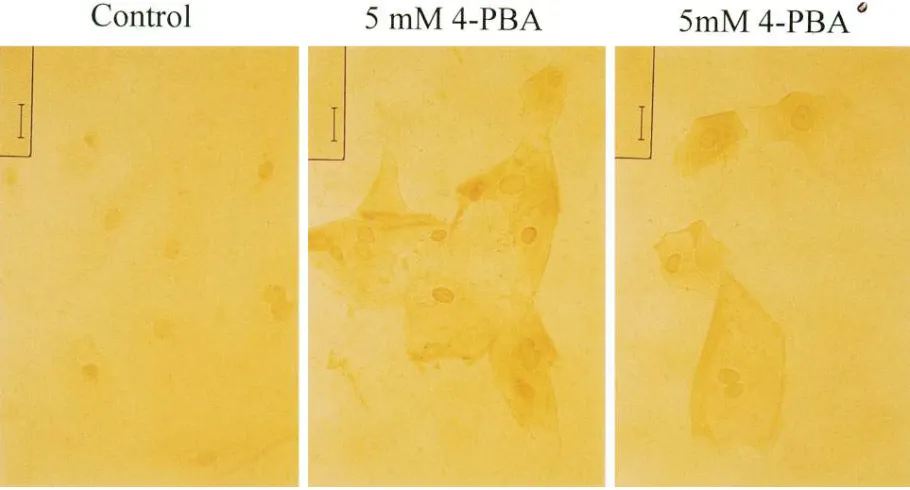 Figure 4. Immunoblot of cell lysates of 4PBA-treated primary nasal epithelium from a CF patient demonstrates molecular mass shifts consistent with oligosaccharide maturation